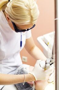 Лікар проводить процедуру фототермолізу