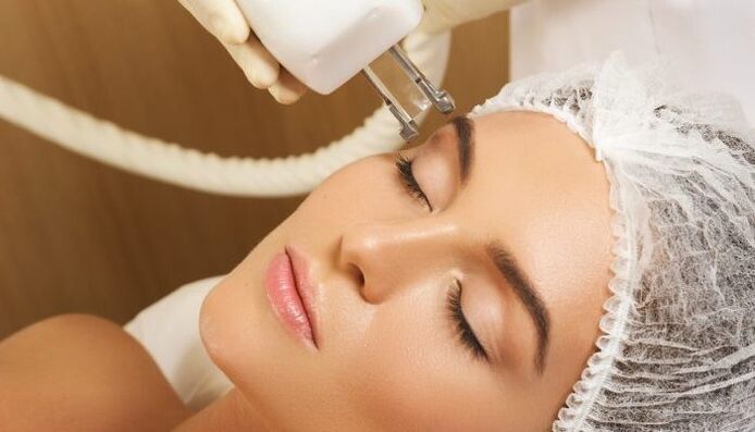 Термоліфтінг