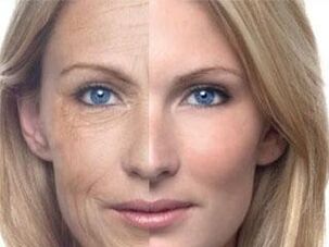 Пігментація шкіри